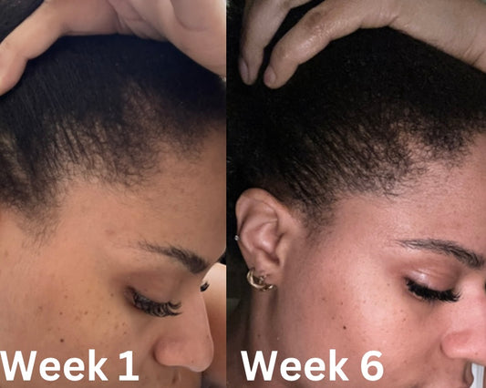 Rosemary & Fenugreek Oil